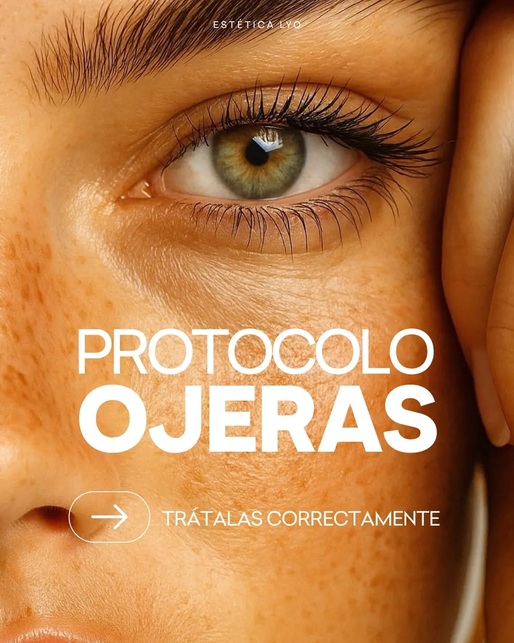 Mirada: tratamiento de medicina estética en Atelier LyO